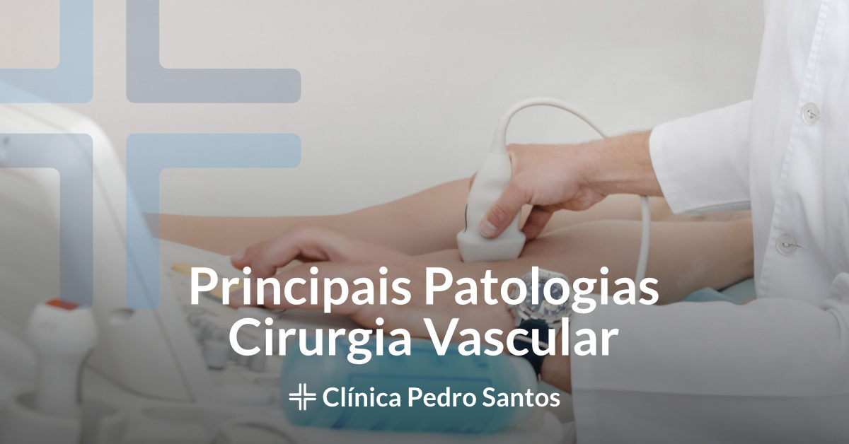 Principais%20patologias%20Cirurgia%20Vascular